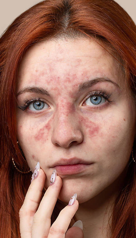 home-1-before-image home-1-before-image