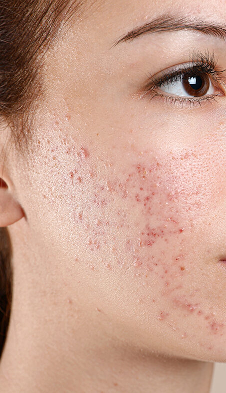 home-3-before home-3-before